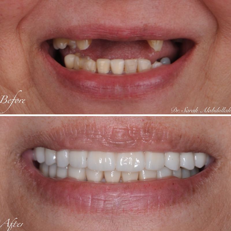 my work (3)